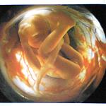 "In the womb" fetus at 6 weeks.